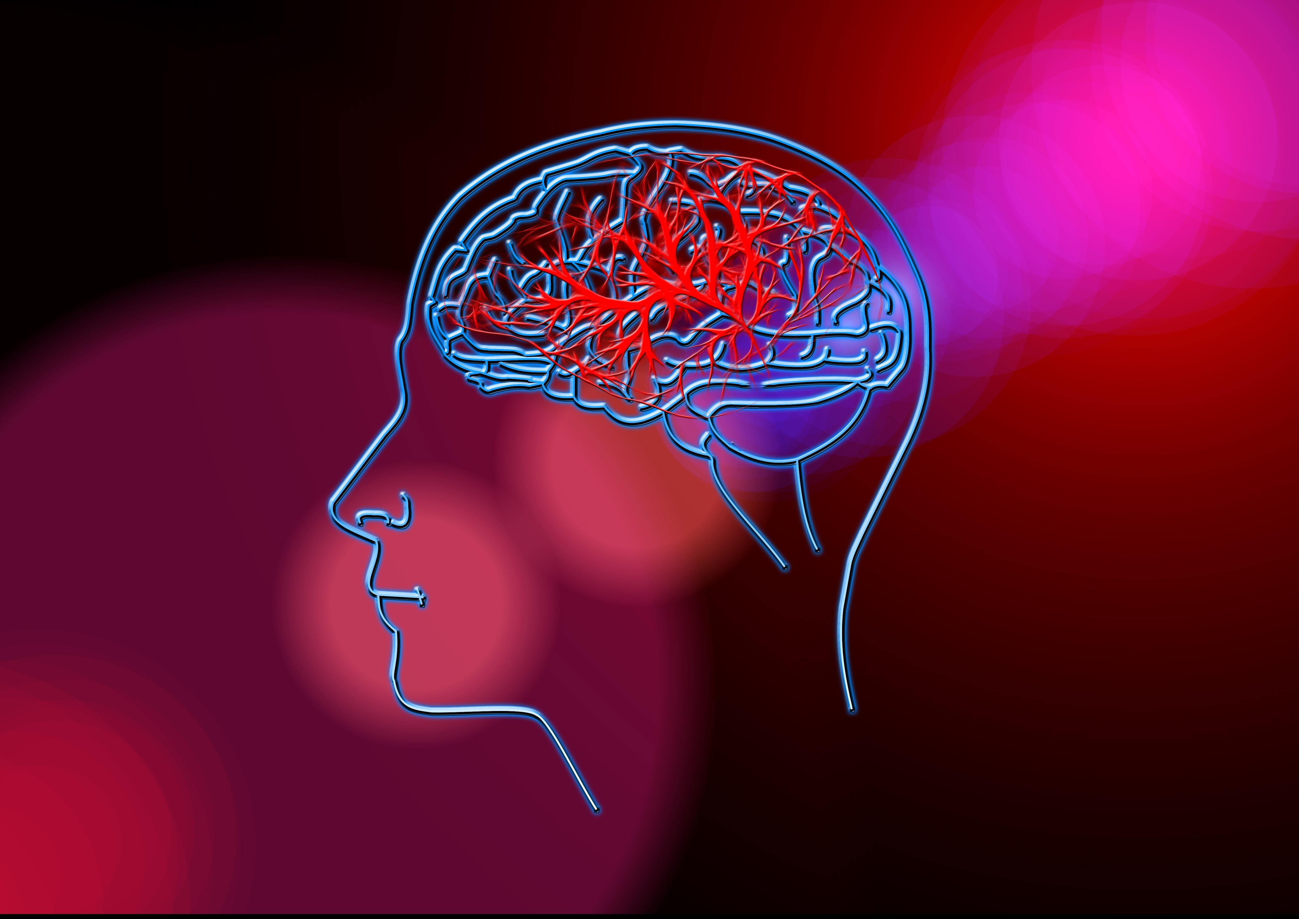 Stroke: What is Your Risk - Thursday, May 14 | noon-12:45 p.m.